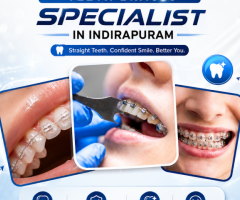 Teeth Braces Specialist in Indirapuram for Perfect Smile Alignment