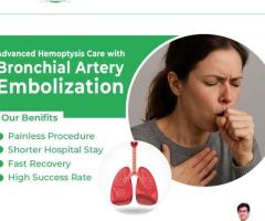 Treatment for Hemoptysis in Chandigarh | Treatment for Lung Bleeding