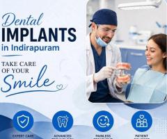 Dental Implants in Indirapuram for Missing Teeth