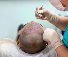 Get Smooth Scalp, Fuller Hair with The Botox Hair Treatment!
