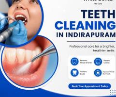 Teeth Cleaning in Indirapuram for a Healthy Smile