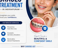 Braces Treatment in Indirapuram for Perfect Alignment