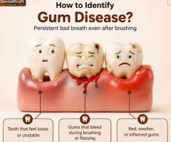 Searching for the Best Dental Clinic in Indirapuram for Your Dental Care?