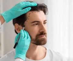 World-Class Hair Transplant in Dubai — Now Within Your Reach!