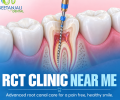 RCT Clinic Near You for Comfortable Root Canal Treatment
