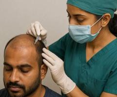 No Need to Break the Bank – Get High-quality Hair Transplant at Affordable Cost - 2