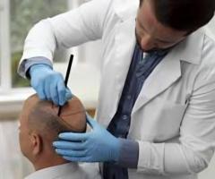 Trusted Hair Transplant Doctor in Melbourne – Dr. Haror’s Wellness