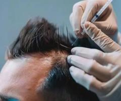 See It to Believe It — Stunning Hair Transplant Before and After at Dr. Haror's Wellness!