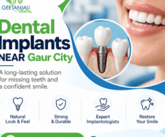 Dental Implants Near Gaur City for Reliable Tooth Replacement