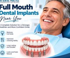 Full Mouth Dental Implants Near You for Complete Tooth Replacement