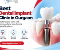 Best Dental Implant Clinic in Gurgaon for Tooth Replacement
