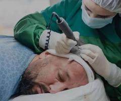 Know the Real Hair Transplant Cost Germany Clinics Quote