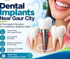 Dental Implants NEAR Gaur City for Missing Tooth Replacement