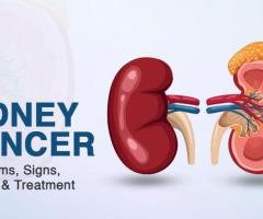 Kidney Cancer Treatments In Bangalore | Worldofurology