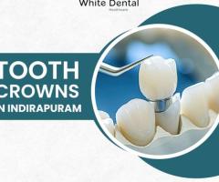 Best Tooth Crowns in Indirapuram | White Dental Healthcare