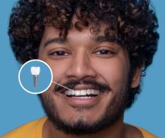 Dental Implants in Indirapuram | White Dental Healthcare