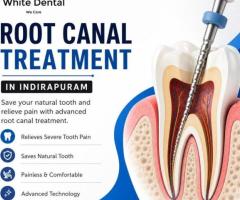 Root canal treatment in Indirapuram for effective tooth preservation.