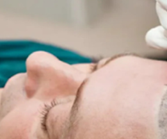 Get Thicker, Stronger & Permanent Hair with Hair Transplant - 2