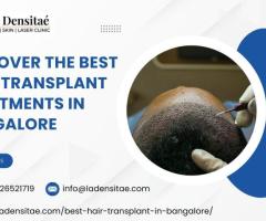 Discover the Best Hair Transplant Treatments in Bangalore