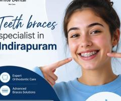 Teeth Braces Specialist in Indirapuram for Better Smile Alignment