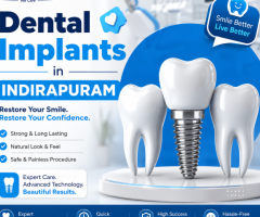 Dental Implants in Indirapuram for Permanent Tooth Replacement