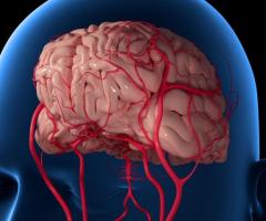 Coiling for Aneurysm: Safe & Minimally Invasive Treatment | IRFacilities