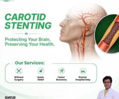 Carotid Artery Stenting - Stroke Prevention through Minimally Invasive Surgery | IRFacilities