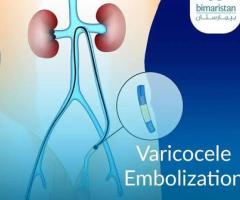 Varicocele Grading Radiology | Advanced Imaging for Precise Diagnosis