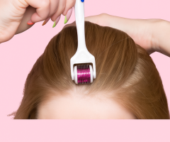 Boost Hair Growth Effectively with a Derma Roller for Hair Loss
