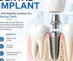 Dental Implant Clinic in Chandigarh for Smiles