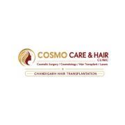 Chandigarh Hair Transplantation